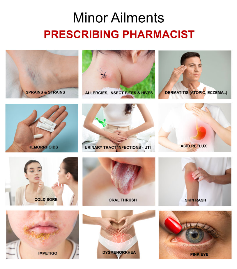 prescribing pharmacist for minor ailments
