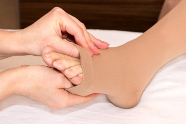Compression Stockings - Why Do I Need To Wear Them After Treatment?